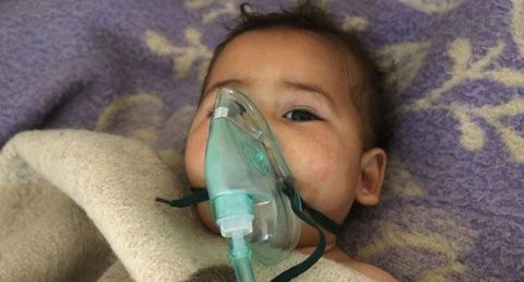 baby recovering from Assad gas attack
